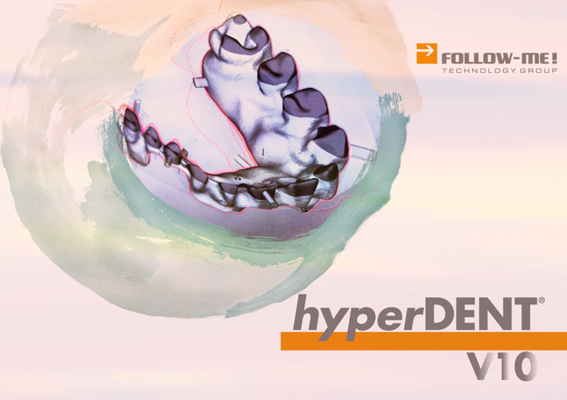 hyperDENT hyperdent-compact NEW V10.0.2 一机一码注册版免加密狗 义齿排版切削牙科软件060220