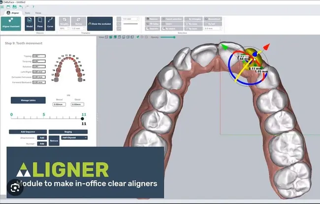 DirectAligner Designer 4.0.3.0 加密狗版数字化牙科正畸矫治器高级机械工程解决方案060266