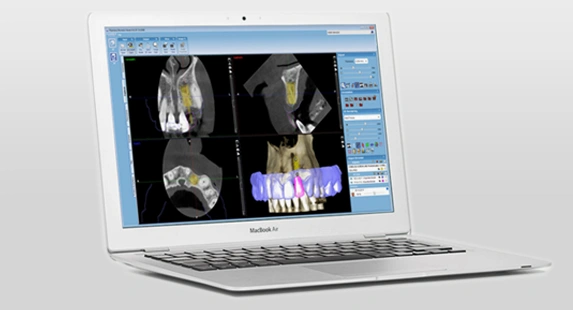 DDS PRO 2.6.1 加密狗版专业牙科CAD软件种植体修复软件工具060267