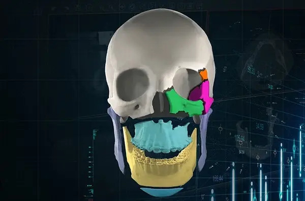 Materialise Mimics Enlight Suite 7.0.1.5 一机一码授权版 先进的3D医学影像与虚拟手术规划软件