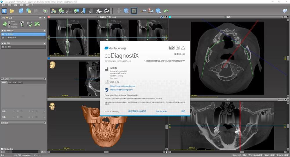 coDiagnostiX 10.10 加密狗版 士卓曼种植导板规划设计软件codiagnostix