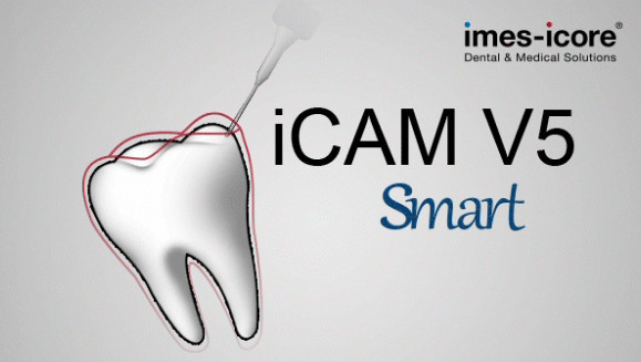 iCAM V5 smart 一机一码授权版 义齿切削排版软件 牙科软件 millbox Imes iCAM V5 Smart